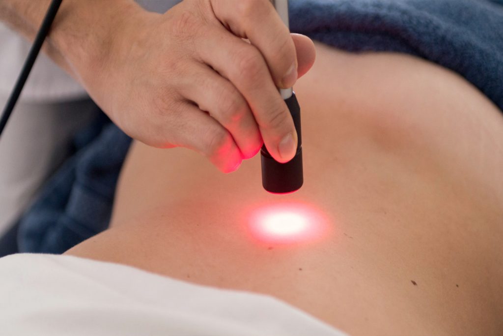 Laserterapia